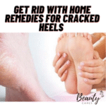 Get rid  with home remedies for cracked heels